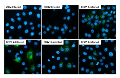 Anti-Dengue virus NS4B protein antibody [HL3844] used in Immunocytochemistry/ Immunofluorescence (ICC/IF). GTX642078